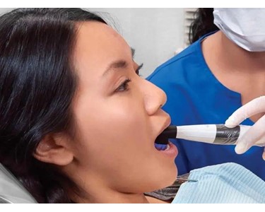 Intraoral Camera | CamX Triton HD