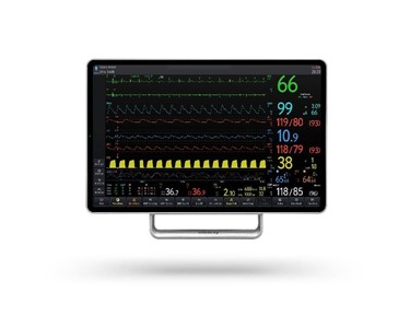 Mindray - V Series Patient Monitors