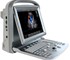 Chison - Portable Ultrasound Machine/Scanner ECO5 Colour Doppler 