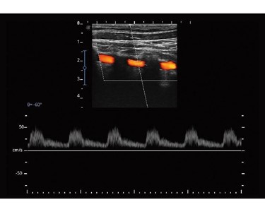 Sonoscape E2 Pro Ultrasound Unit