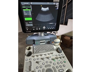 GE - Voluson P8 Ultrasound EX4822