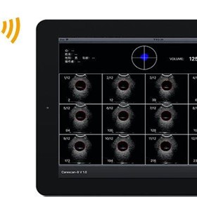 Bladder Scanner | Wireless for iOS devices