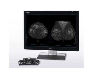Hologic - Imaging Technology | 3DQuorum
