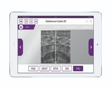 MyRay - 3D CBCT Imaging System – MyRay ProXima X6