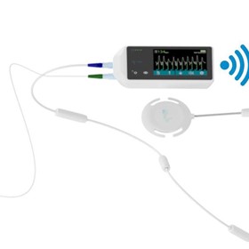 Foetal smart-sync Doppler Ultrasound Gating for Cardiac MRI