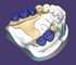 ExoCad - Dental Imaging Software | Stand Alone Partial CAD Module