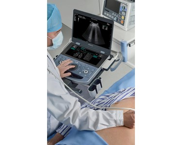 Mindray - Dedicated Portable Ultrasound System | ME Series