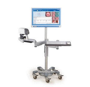 AI HD Gynaecology Colposcope | C6A