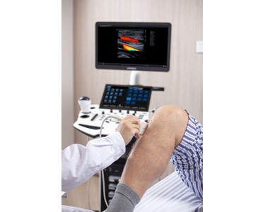 Vinno - Cart-Based Ultrasound | VINNO S300 