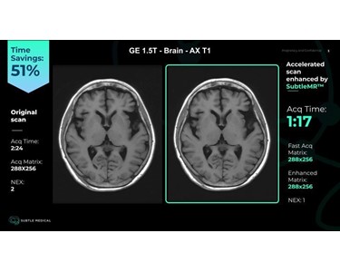 Subtle Medical - SubtleMR™ - AI Software