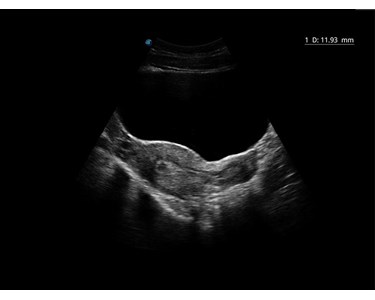 SonoScape - E2 Portable Color Doppler Ultrasound System