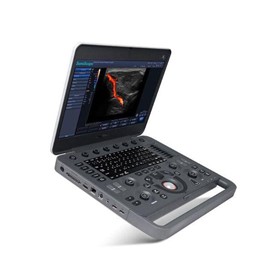 X5 Portable Colour Doppler Ultrasound
