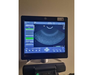 GE - Voluson P8 | Ultrasound Machine | EX2865