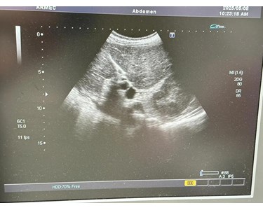 Toshiba - Xario Ultrasound | Ultrasound Machine | NEX335