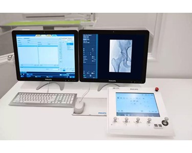 Philips - Fluoroscopy System | CombiDiagnost R90