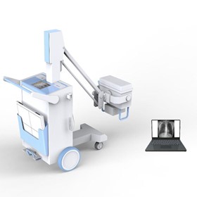 Digital Mobile X-Ray PLX5100 Without Battery 