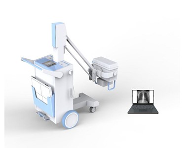 Digital Mobile X-Ray PLX5100 Without Battery 