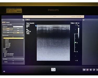 Philips - Epiq 7G | Ultrasound Machine | EX3375