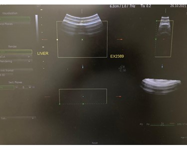 GE - RAB4-8-RS [Ultrasound Transducer] [EX2389]