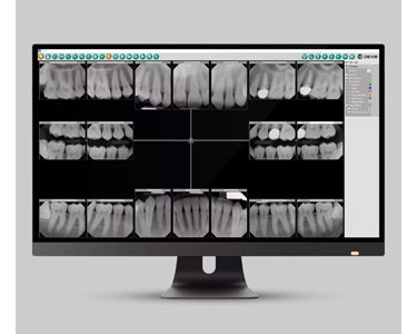Dexis - Imaging Software | Imaging Suite