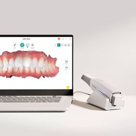 Imprevo Intraoral Scanner