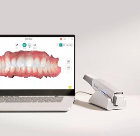 Imprevo Intraoral Scanner