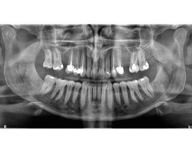 Carestream Dental - Dental 3D Imaging System | CS 8200 3D Access