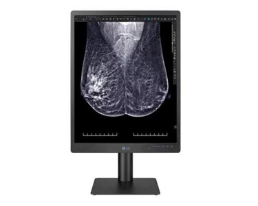 LG - 5MP 21″ Colour Mammography 3D Tomosynthesis Breast Imaging Display Monitor