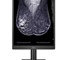 LG - 5MP 21″ Colour Mammography 3D Tomosynthesis Breast Imaging Display Monitor