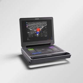 Ultrasound System | Sonosite MT