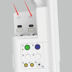 F1 Smart Compact Patient Monitor | Portable Transport & Modular Bedsid