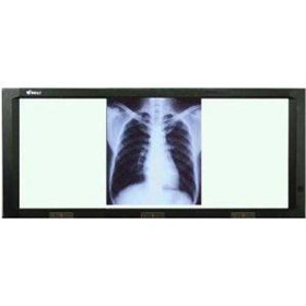 X-Ray Viewing Box | 3 Bay ATX LED