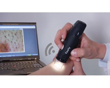 Firefly - Wireless Digital Video Dermatoscope 