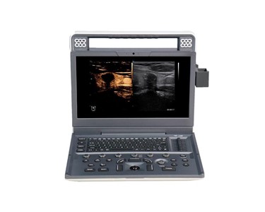 Siui - Portable Ultrasound Machine | Apogee C2  