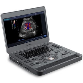 X3 real-time portable Colour Doppler Laptop Ultrasound Machine