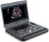 SonoScape - X3 real-time portable Colour Doppler Laptop Ultrasound Machine