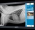 Radiography System | Small Animal Smart DR