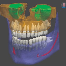 3D CBCT Imaging System – MyRay ProXima X6