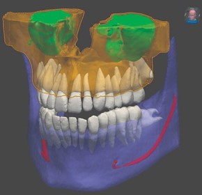 3D CBCT Imaging System – MyRay ProXima X6