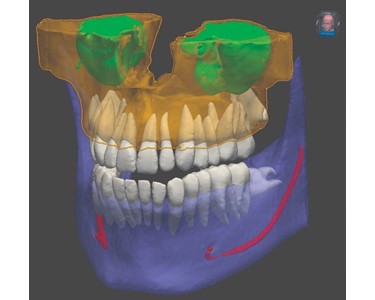 MyRay - 3D CBCT Imaging System – MyRay ProXima X6