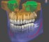 MyRay - 3D CBCT Imaging System – MyRay ProXima X6