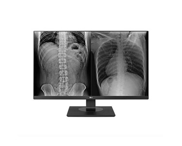 LG - Clinical Review Display