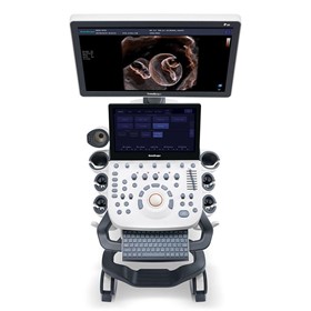 Ultrasound System | P20
