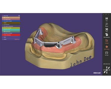 ExoCad - DentalCAD Add-On Modules