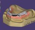 ExoCad - DentalCAD Add-On Modules