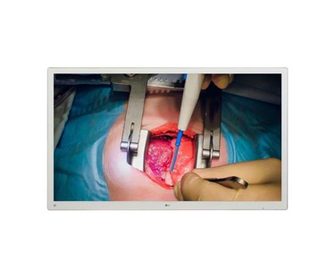 LG - Surgical Display | LGE-55MH5K-W