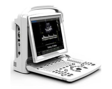 Chison - Ultrasound Machine 