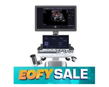 SonoScape - Ultrasound System | P40