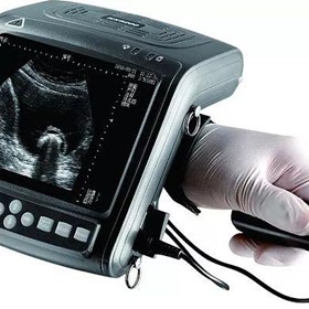 Full Digital Hand Held Ultrasound Scanner | KX 5200v