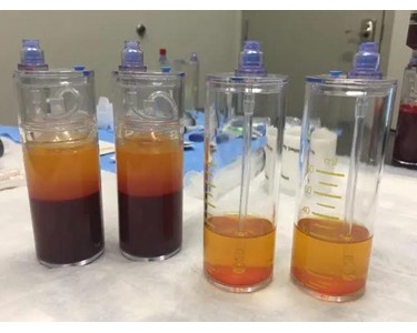 High Platelet and Purity PRP | EmCyte PureTWO